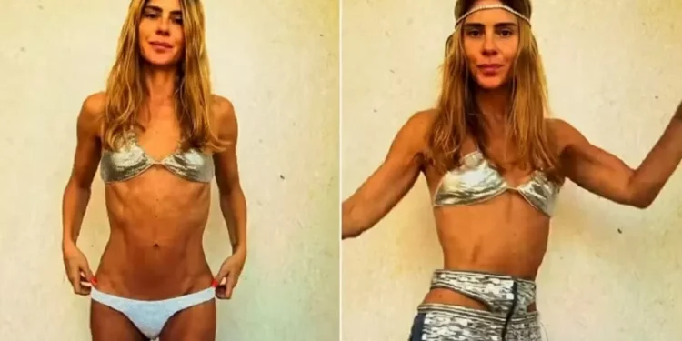 Carolina Dieckmann reage a comentários sobre seu corpo e nega uso de Ozempic