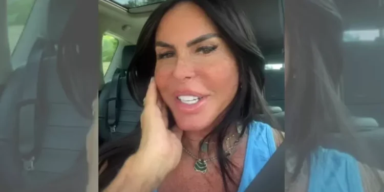 Gretchen rebate uso de filtro e comemora resultado de harmonização facial: ‘Rosto mais fino’