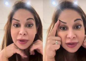Maíra Cardi exibe rosto deformado após botox dar errado: ‘Olha que palhaçada’