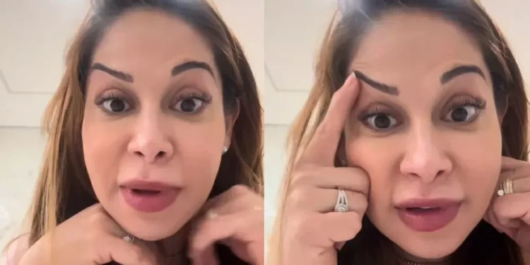 Maíra Cardi exibe rosto deformado após botox dar errado: ‘Olha que palhaçada’